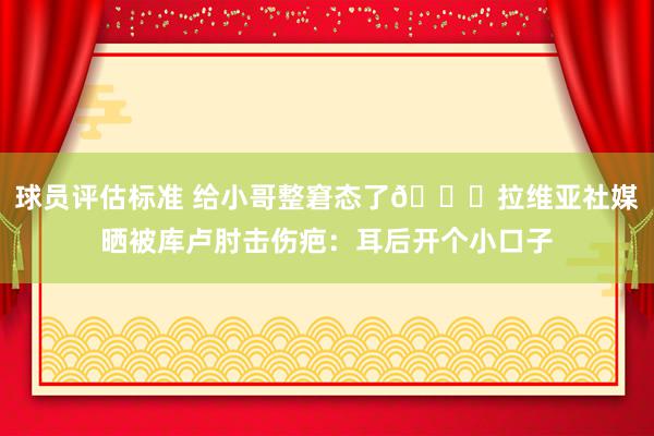 球员评估标准 给小哥整窘态了😅拉维亚社媒晒被库卢肘击伤疤：耳后开个小口子